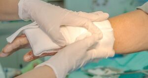 Doof meisje in India in brand gestoken 479_india_V&VN